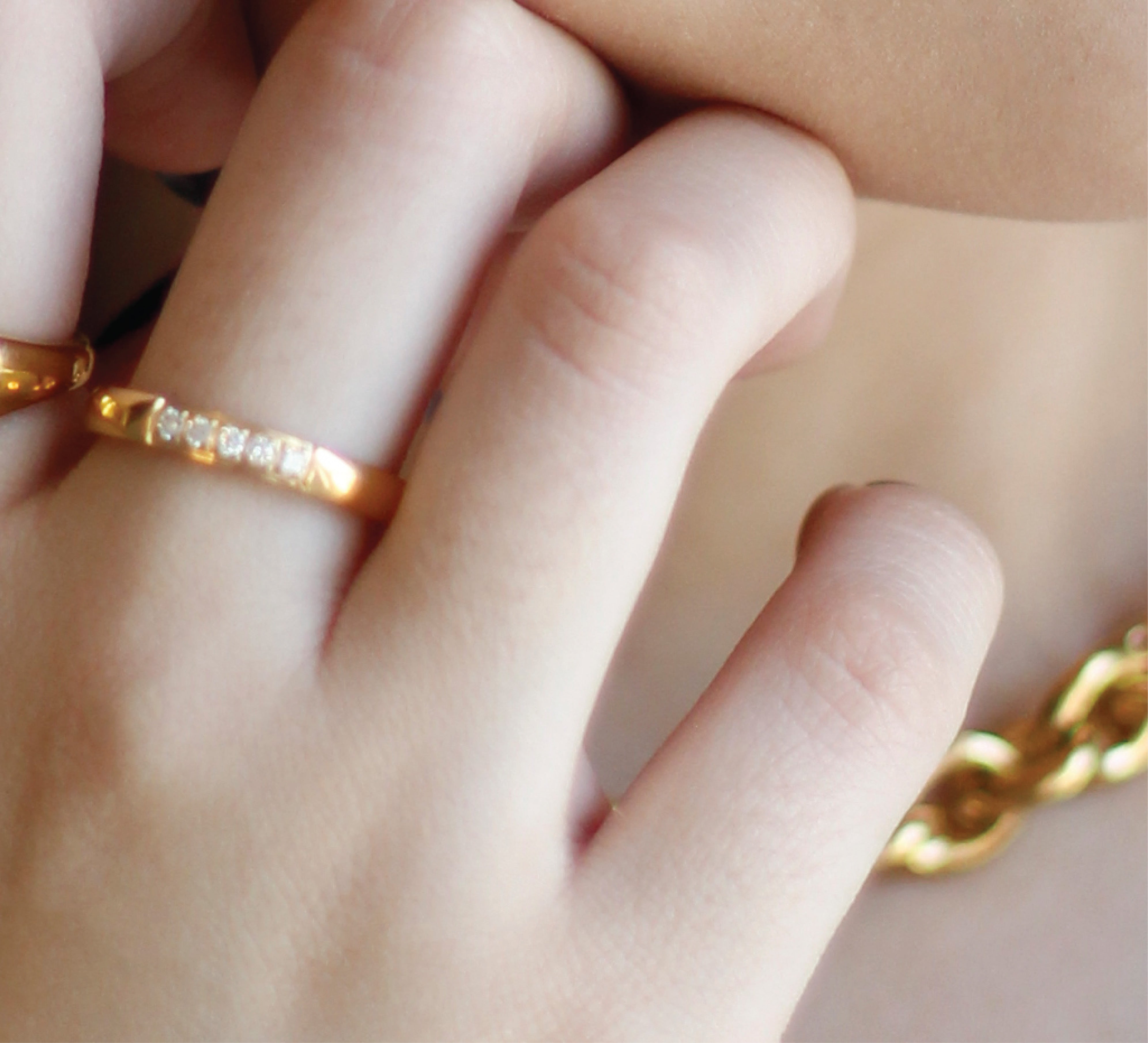 Anillo Marbella